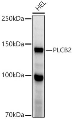 Western Blot: Phospholipase C beta 2 AntibodyAzide and BSA Free [NBP2-93815]